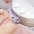 The Benefits of Facials and Skin Treatments